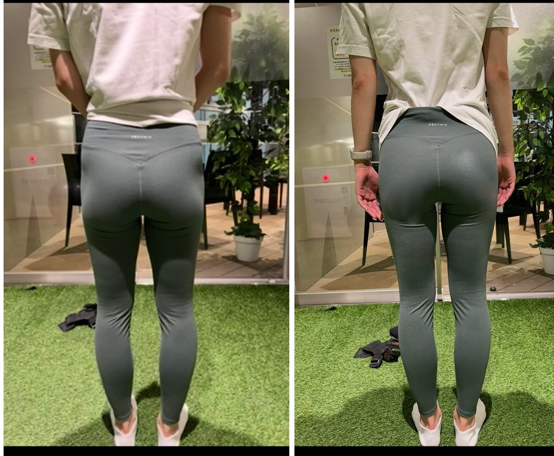 Y.Iさんのビフォーアフター